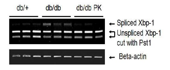 Expression of Xbp-1 mRNA in db/db mouse fed experimental diets.