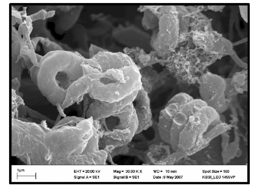 SEM photograph of Streptomyces yatensis