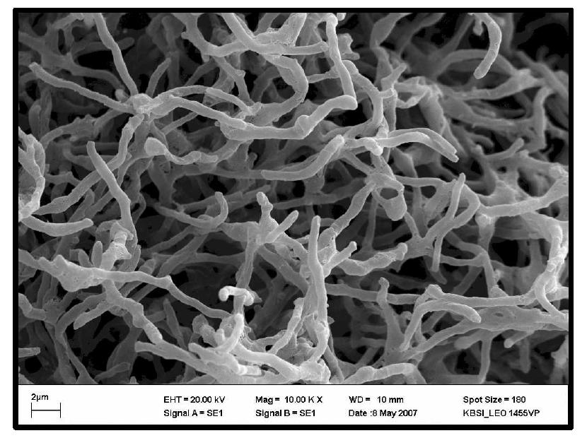 SEM photograph of Sreptomyces misonensis