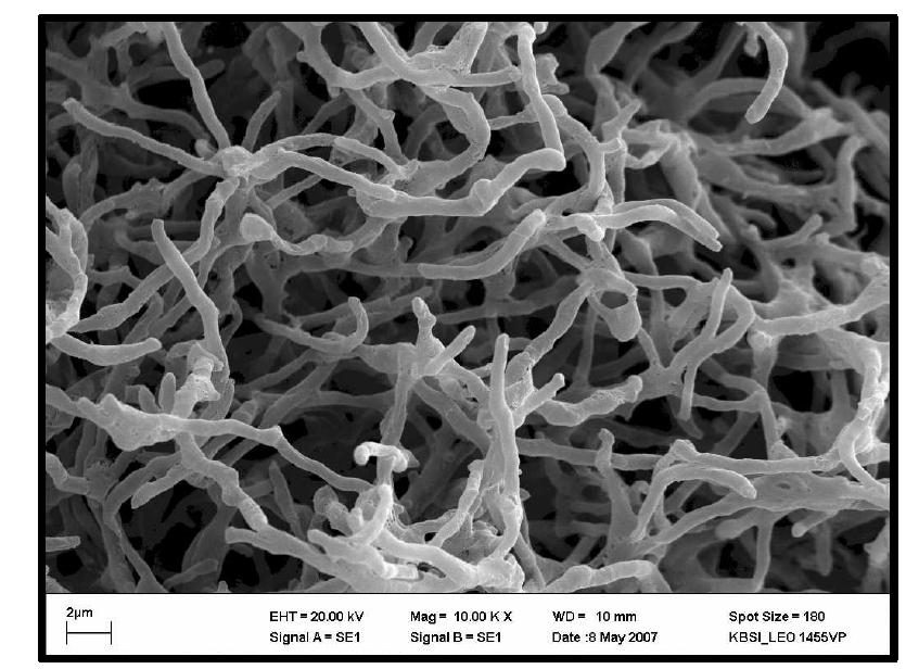 SEM photograph of Streptomyces hygroscopicus subsp. glebosus사진