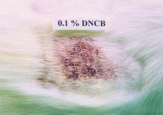 Reaction state of guinea pig observed at 24 hours after topical application of 0.1% DNCB (dinitrochlorobenzene in 10% PG) (0.2 ml/animal). Intense redness, schar & edema were observed.
