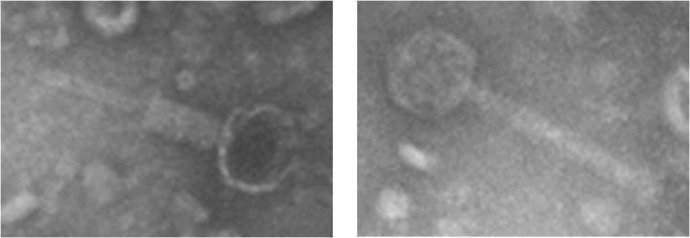 Electron micrograph showing morphology of phage ENT90 (A) contracted tail, (B)non-contracted tail