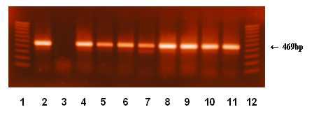 Detection of C. sakazkaii by amplification of ompA gene. Lanse; 1,12 : 100 bp ladder, 1: C. sakazkaii ATCC 29544(positive control), 2: E. cloacea KCTC 1949(negative control) 3-11: C. sakazkaii wild strains