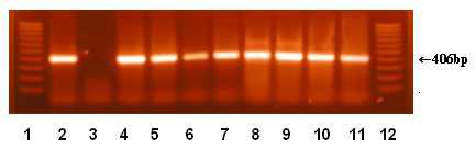 Detection of C. sakazkaii by amplification of 16S rRNA. Lanse; 1,12 : 100 bp ladder, 1: C. sakazkaii ATCC 29544(positive control), 2: E. cloacea KCTC 1949(negative control) 3-11: C. sakazkaii wild strains