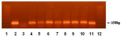 Detection of C. sakazkaii by amplification of tRNA-Glu and 23S rRNA의 intergenic space. Lanse; 1,12 : 100 bp ladder, 1: C. sakazkaii ATCC 29544(positive control), 2: E. cloacea KCTC 1949(negative control) 3-11: C. sakazkaii wild strains