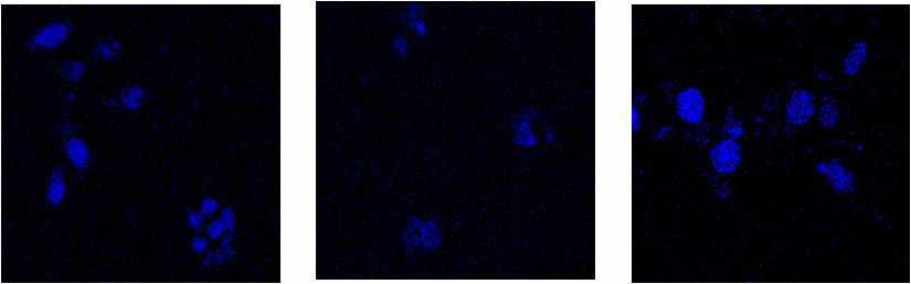 Morphological analysis of nucleus in RIN-m5F cells.