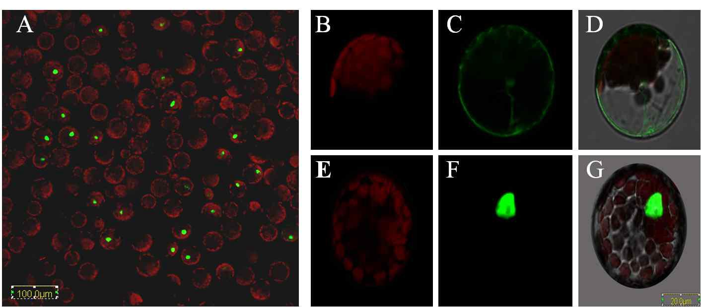 35S::EGFP-WRKY45 construct를 Arabidopsis protoplast cell에 형질전환 시킨 후 전체 cell를 확인 한 결과