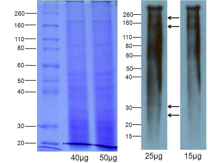노무라입깃해파리 독소의 1차원적 단백질 및 항원 단백질 구조