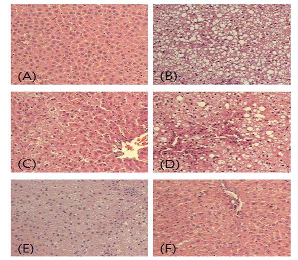 Histological character of liver in SD male rats
