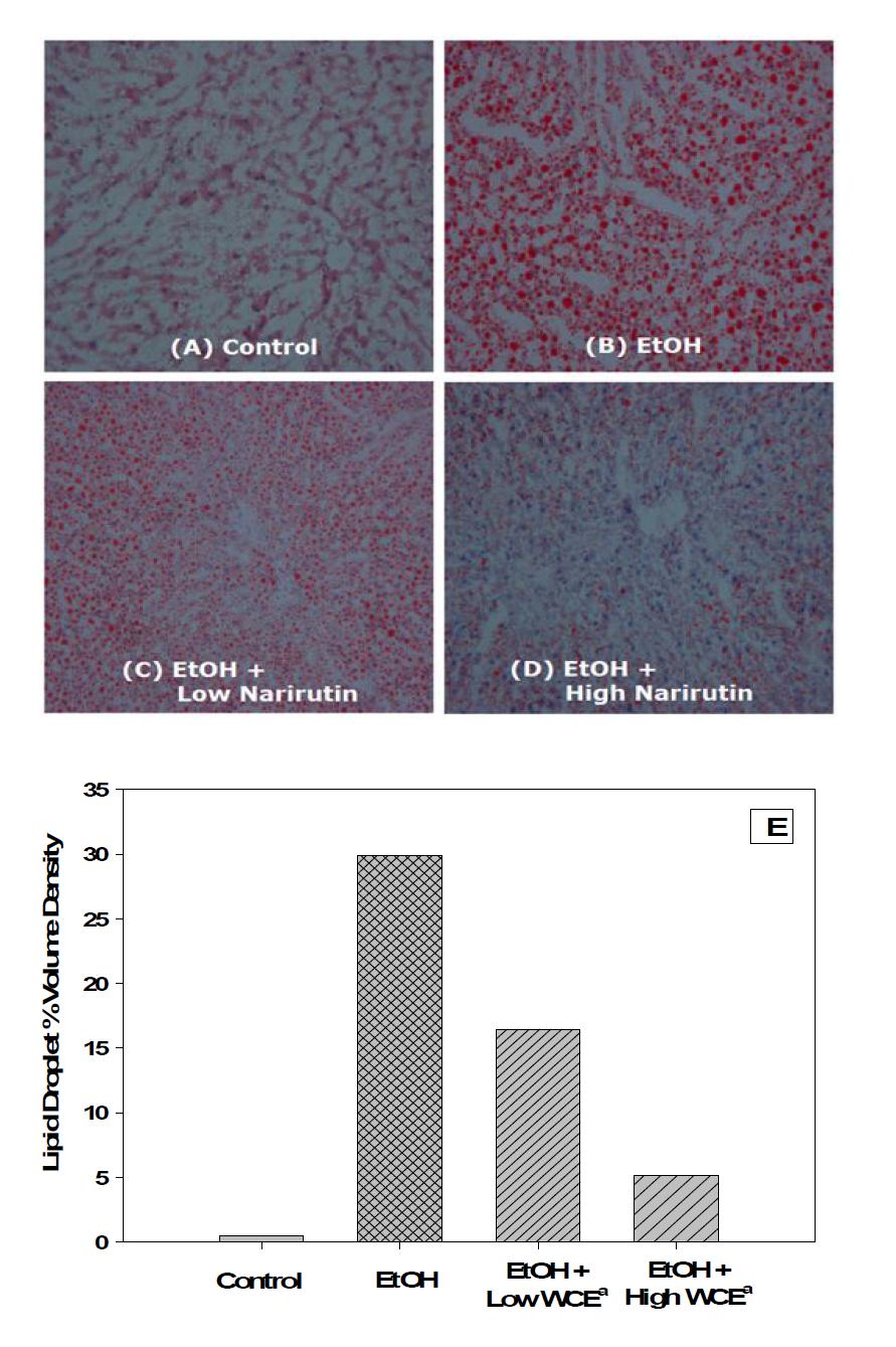 Narirutin추출물 투여에 따른 알콜성 지방간조직의 histological평가
