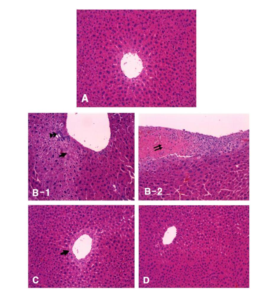 에탄올을 8주간 장기 투여한 mouse간조직에서 narirutin의 간손상 억제 효과.