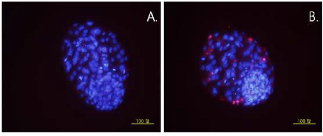 Tunel 염색에 의한 Apoptosis 비교(A. puncture, B. control).