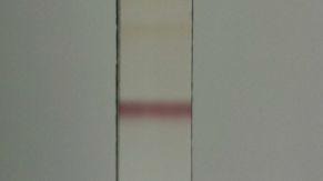 Prep TLC forrecovery ofcompound K unreacted after enzymatic esterification with lipase (with a developing solvent of CHCl3:CH3OH:H2O (13:2:0.3)