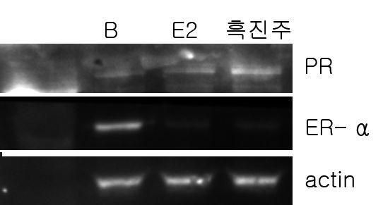 흑진주의 MCF-7cells에서 PR과 ER-α 단백질 발현에 대한 영향. *B:control,E2:17ß-estradiol10pμ,흑진주:흑진주벼 50ppm