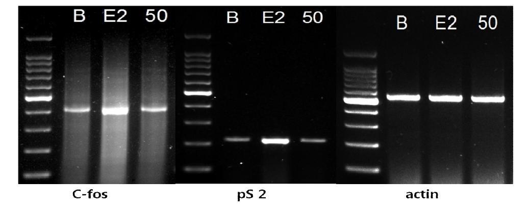 흑진주벼의 MCF-7cell에서 c-fos와 pS2mRNA 발현에 대한 영향 *B:control,E2:17ß-estradiol10pμ,50:흑진주벼 50ppm