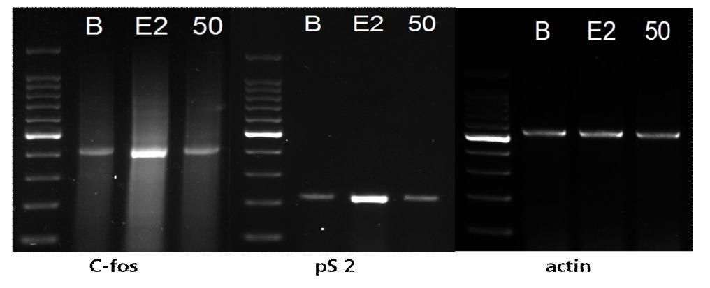 수원425호의 MCF-7cell에서 c-fos와 pS2mRNA 발현에 대한 영향 *B:control,E2:17ß-estradiol10pμ,50:수원425호 50ppm