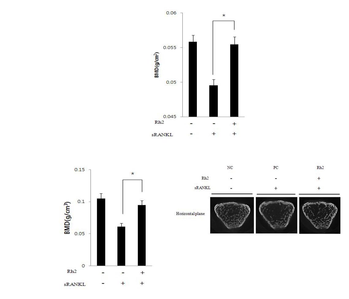 마우스 동물모델에서 Rh2의 골다공증 저해효과 분석