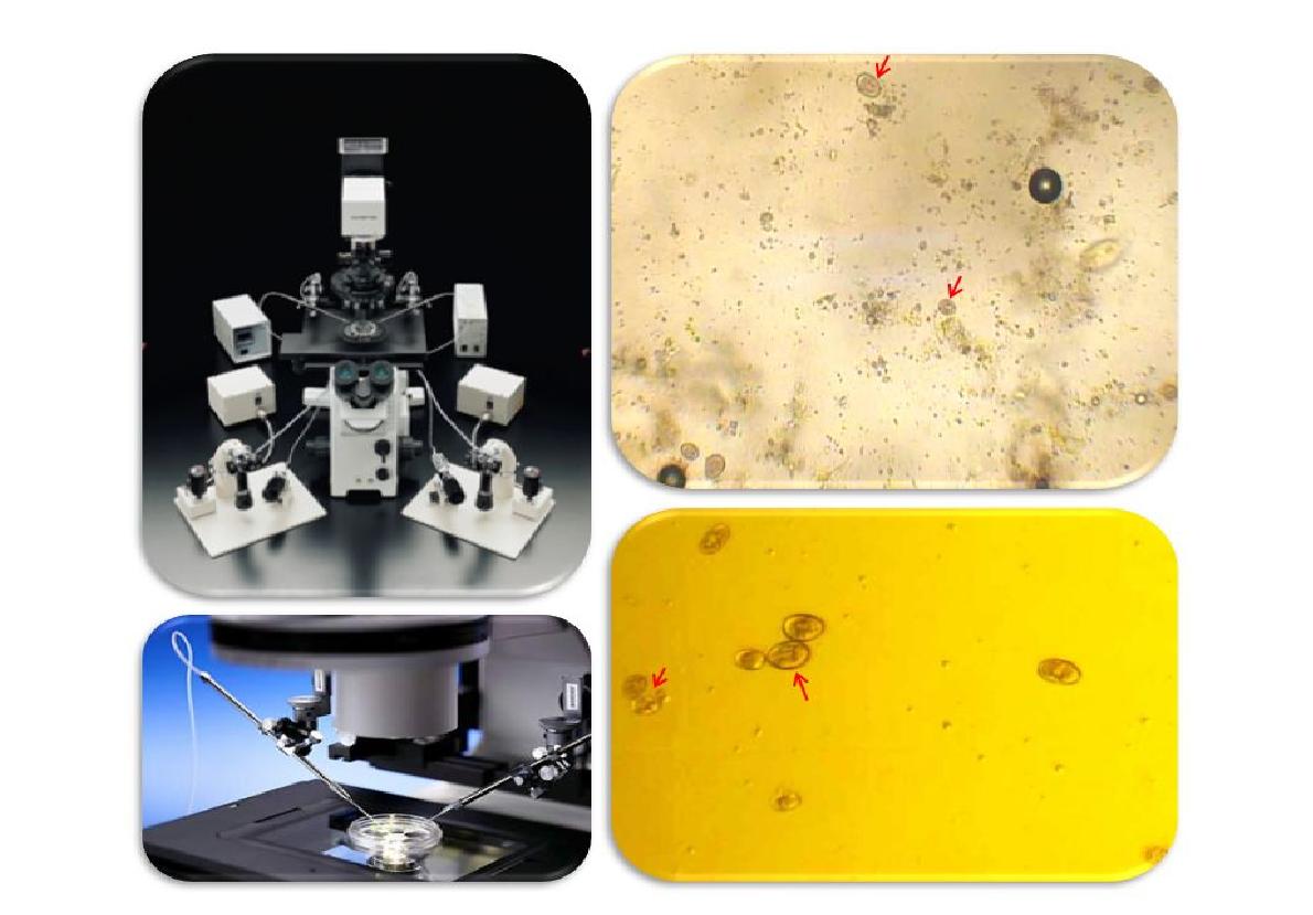 Isolation of a single Eimeria oocyst from poultry litter using amicromanipulator.Arrowsindicatedsporulatedoocystsinfecalsamples