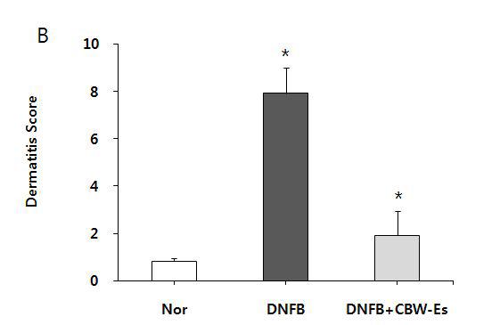 Effects ofCBW-Es on the clinicalsign ofthe skin lesion inDNFB-treatedNC/Ngamice