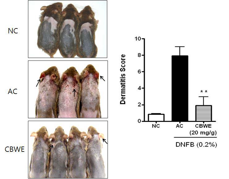 Effects ofCBWE on the clinicalsigns ofatopic dermatitis inNC/Ngamice