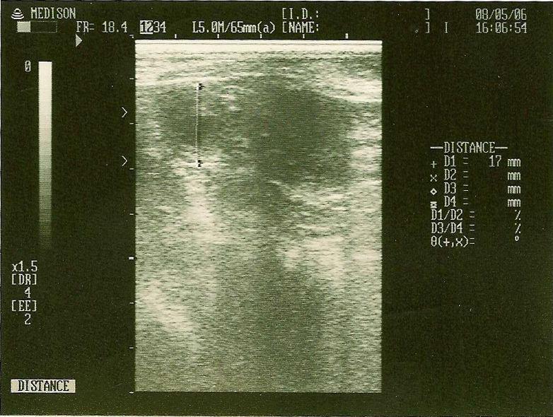 Ultrasonography of a gestation sac after artificial insemination in female dog at day 25