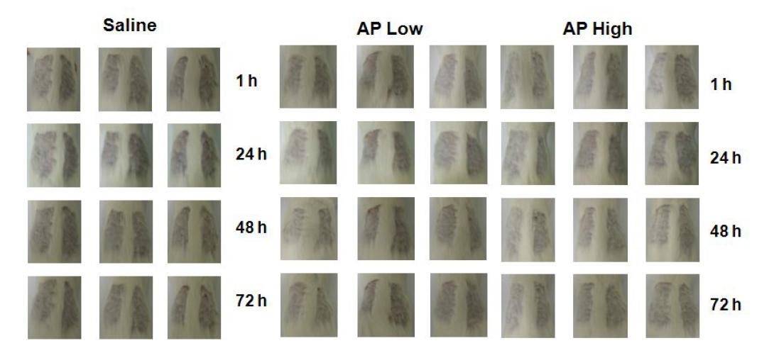 Acute Skin Toxicity of Artemisiaprinceps(AP)by Draize Test