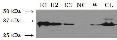 정제된 E2 항원에 대한 western blot