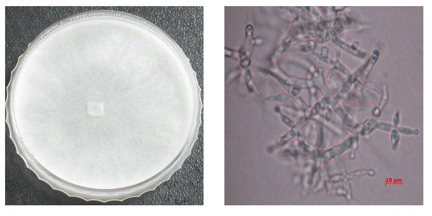 PDA에서 자란 Trichodermaatroviride의 colonymorphology(왼쪽),현미경으로 관찰한 포자모습(오른쪽).Barsmeans10㎛.