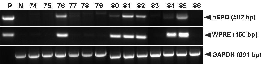 PCR analyses of G0 LNOv32EPOWⅢ transgenic chickens.