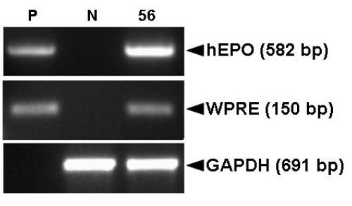 PCR analyses of G0 LNOv42EPOWⅠ transgenic chickens.