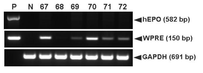 PCR analyses of G0 LNOv42EPOWⅢ transgenic chickens.