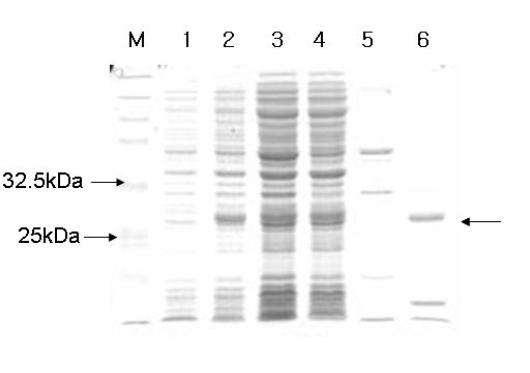 hEPO expression in E.coli BL21 and purification.