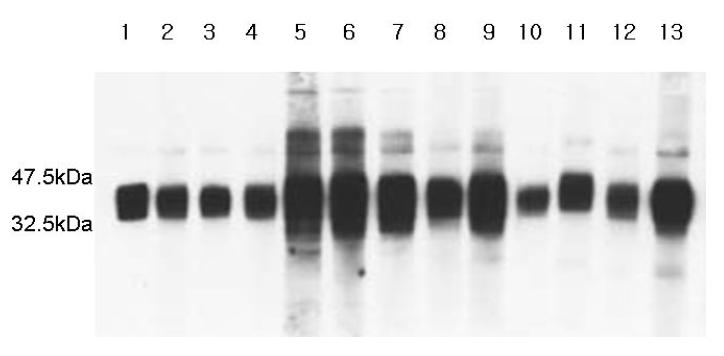 Wetern blotting of hEPO using cell culture supernatant.