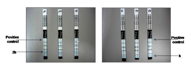 Photogram of isotype kit for determining the subclass of immunoglobulins produced by hybridoma cell.