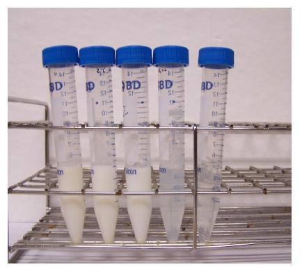 Effect of diafiltration. 1.sample, 2.10mM ZnCl2, 3.0.45um filtration sample, 4. MW 100,000 cut of ffiltration sample, 5.MW 10,000 cut of ffilter concentration sample