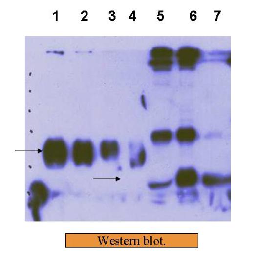 Western bolt of hEPO.1,2,3,4,EPO standard 200ng,150ng,100ng,50ng.5, sample 6,10mM ZnCl2 treated sample.7,diafiltration sample.