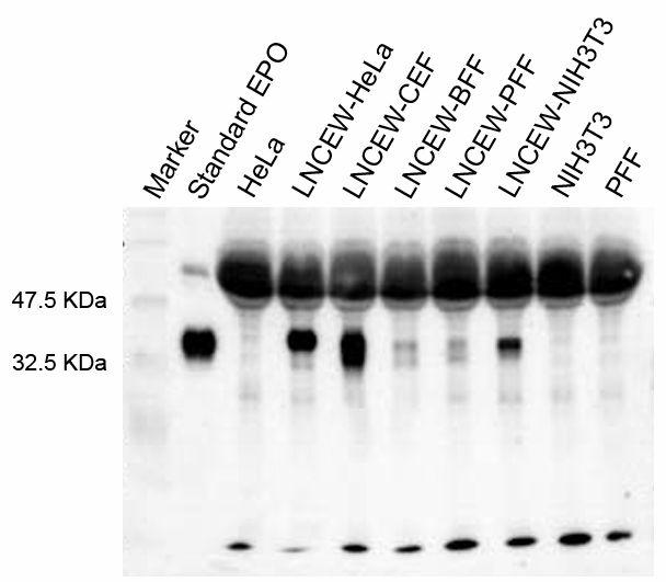 Western blot analyses of hEPO expression invarious target cells