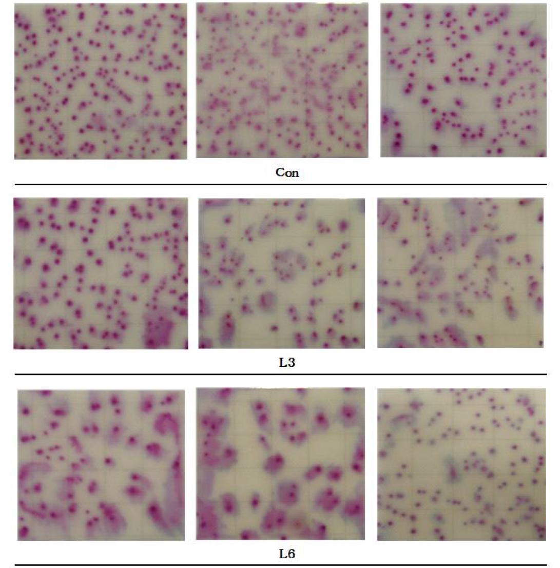 분 내 E. coli 수를 조사하기 위해 미생물 배지에 24시간 배양 시키고 관찰된 E. coli를 촬영