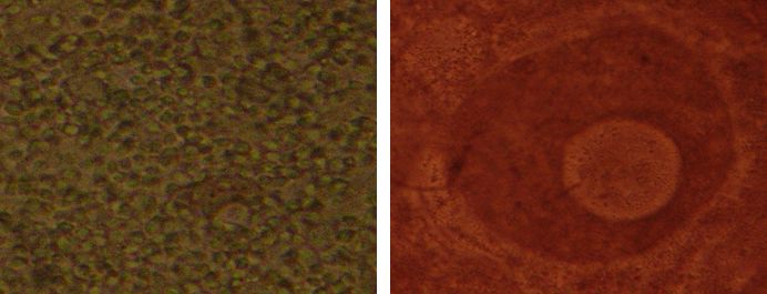 현미경으로 관찰한 바지락의 정자와 난자