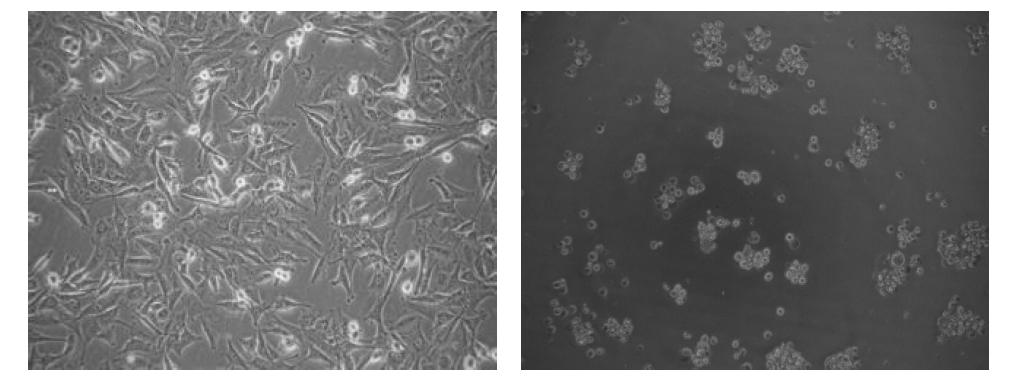 Inverted microscopic photograph of normal Crandell-reese feiline kidney (CrFK) CCL-94 cells (left) and CrFK cells infected by feline calicivirus (right) after 24 hr