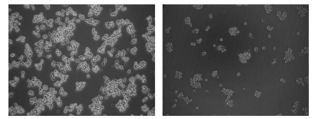 Inverted microscopic photograph of normal raw 264.7 murine macrophages (left) and raw 264.7 cells infected by murine norovirus (right) after 24 hr