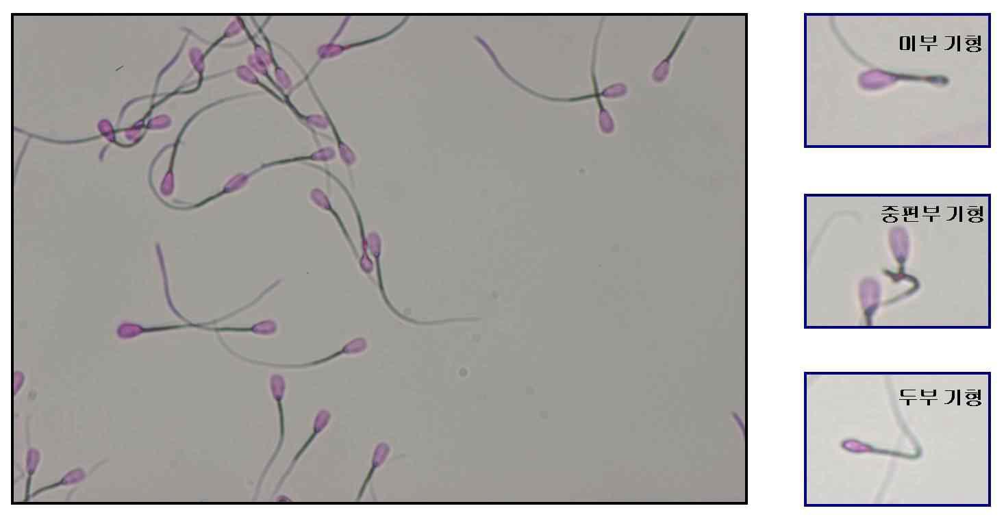 소 정자의 외형적 기형분석을 위해 Rose Bengal로 염색한 소 정자의 모습