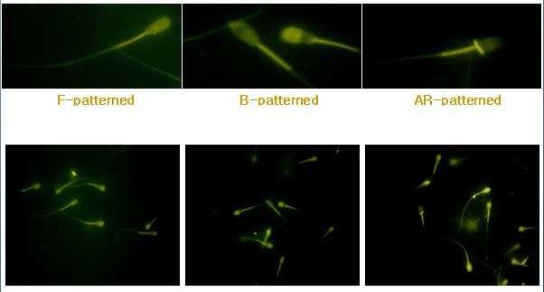 CTC 염색을 형태레 따라 소 정자의 첨체 상태를 3pattern(F, B, AR)으로 분류한 모습