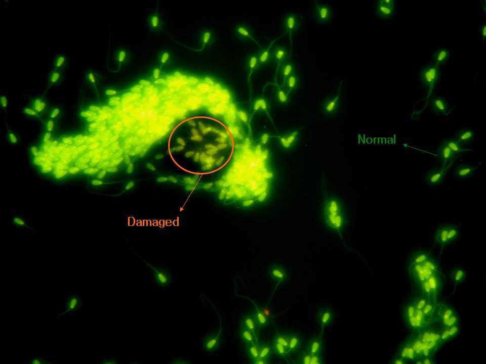소 정자의 DNA 구조 손상분석을 위해 Acridine Orange로 형광염색한 모습