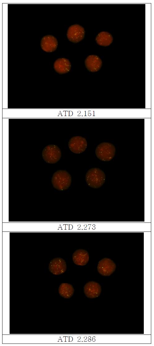 The representative telomere distribution patterns of lymphocytes in terphase nuclei in broiler by FISH using telomeric DNA probe; ATD(Amount of Telomeric DNA)