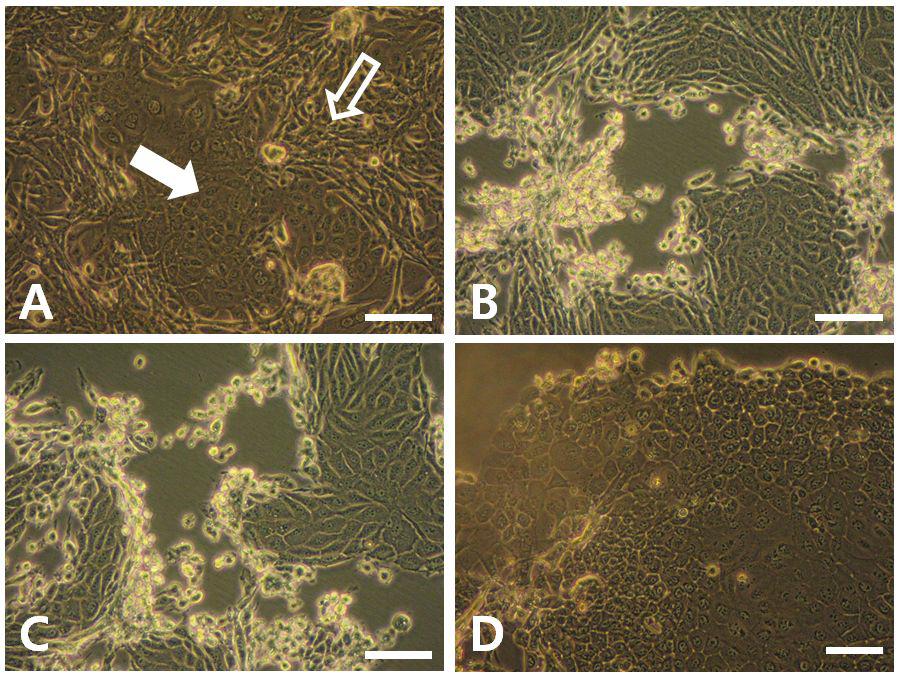 Separation offibroblasts from epithelialcells by treating with Na2EDDA.A: Cultured cells before Na2EDDA treatment.Empty arrow indicates fibroblasts and filled arrow indicates epithelial cells. B: Fibroblasts were rounded and detached from culture-flask by the first Na2EDDA treatment. C: Fibroblasts were detached from culture-flask by thesecond Na2EDDA treatment.D:Fibroblastswerecompletely removed from theflaskbythethirdNa2EDDA treatment.Scale-bar:40μm.