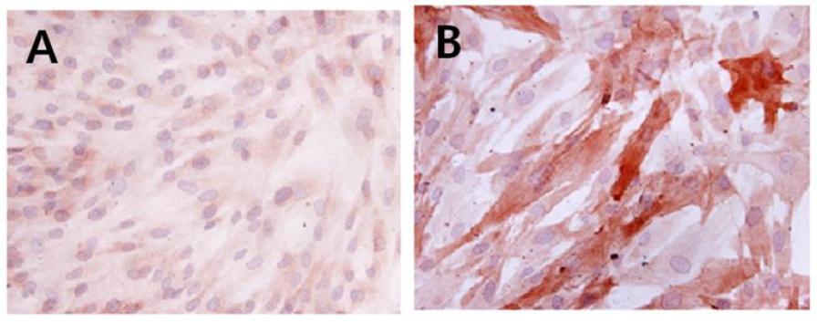 Keratin staining fortheconfirmation ofepithelialcell.A:primary bovinekidney epithelialcell(5th passage),B:JNUSK-1B (35th passage)were stained by anti-keratin antibodies