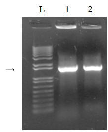 The result of 16S rRNA PCR of colonies.