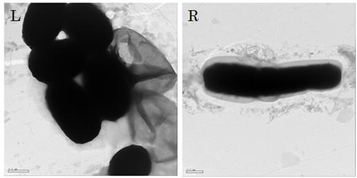 EF-TEM images of Bacillus. Oval shape is spore (L) and rod shape is vegetative cell (R).