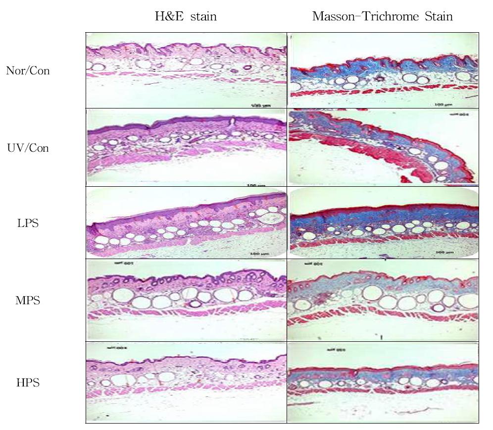 Histological section of dorsal skin of hairless mice exposed to the chronic UV irradiation